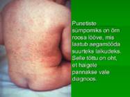 PUNETISED #4