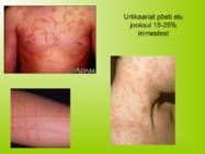 URTIKAARIA #2