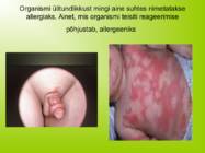 URTIKAARIA #8