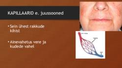 VERESOONED JA VERERINGE #6