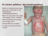 Põletushaavade põhjused-diagnoos-esmaabi ja ravi #26