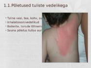 Põletushaavade põhjused-diagnoos-esmaabi ja ravi #5