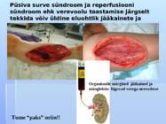 Operatsiooni järgne haige jälgimine veresoontekirurgias #13