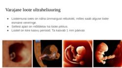 Loote areng #7
