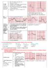EKG konspekt #11