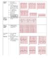 EKG konspekt #13
