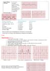 EKG konspekt #15