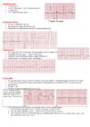 EKG konspekt #16