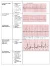 EKG konspekt #4