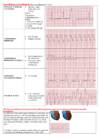 EKG konspekt #5