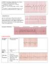 EKG konspekt #6