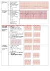 EKG konspekt #7