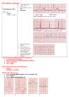 EKG konspekt #10
