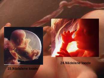 Inimese prenataalne areng #7