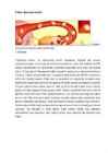 Rasedus #4