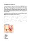 Rasedus #6