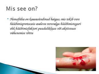 Hemofiilia #2
