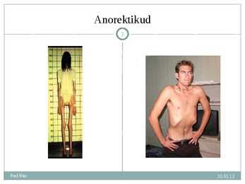 PP kodutöö #3
