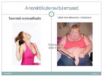 PP kodutöö #5