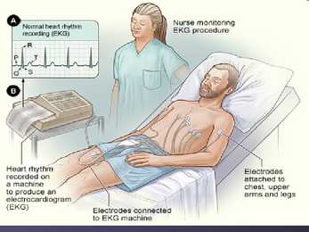 EKG #10