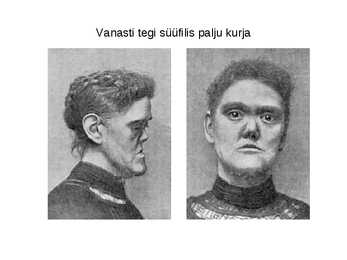 Bakteriaalsedhaigused #10
