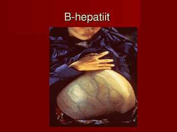 B-hepatiit #8