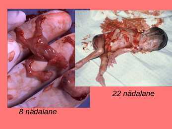 Esitlus abordist #4