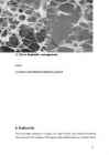 Osteoporoos - referaat #8