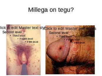 Suguhaiguste kirjeldused koos piltidega #5