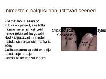 Seente kahjulikkus #5