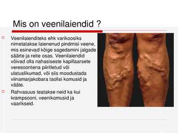 Veenilaiendid #2