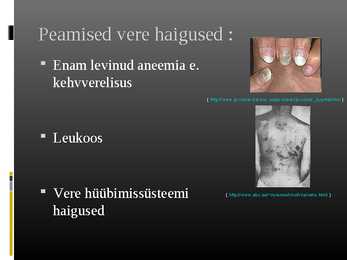 Veredoping #4