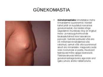 Sinu seksuaalsus #17