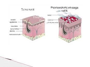 Psoriaas #6