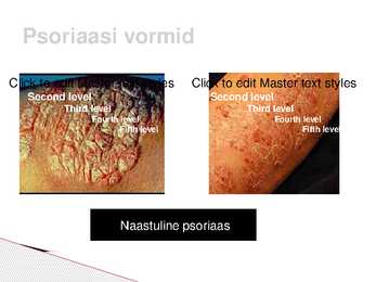 Psoriaas #7