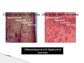 Psoriaas #8