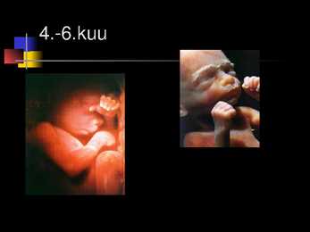 Raseduse kulg #14