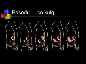 Raseduse kulg #4