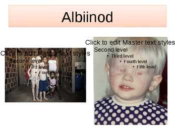 Albinism #7