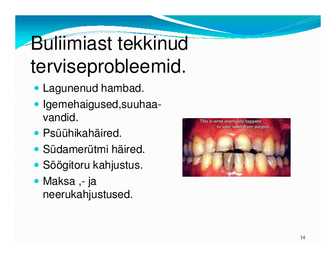 Laste toitumishäired #14