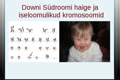 Downi sündroom-slideshow #6