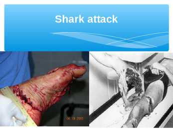 Presentation Sharks #9
