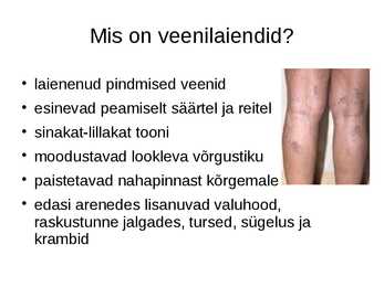 Veenilaiendid #2