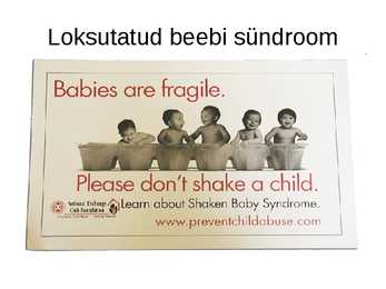 Närvisüsteemi tutvustav esitlus #19