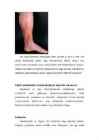 Veenilaiendid #8
