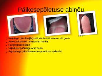 Päikesekaitse esitlus #7