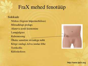 Fragiilne X sündroom #12