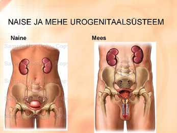 Naise ja mehe urogenitaalsüsteemi uurimine slideshow #2