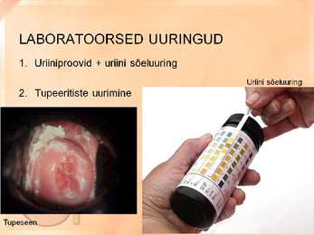 Naise ja mehe urogenitaalsüsteemi uurimine slideshow #5