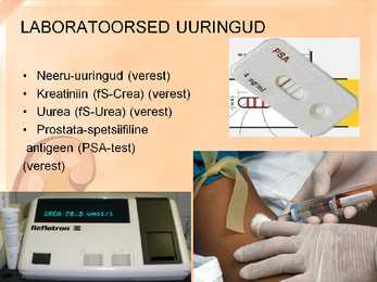 Naise ja mehe urogenitaalsüsteemi uurimine slideshow #6